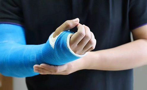 Broken Arm Car Accident Settlement