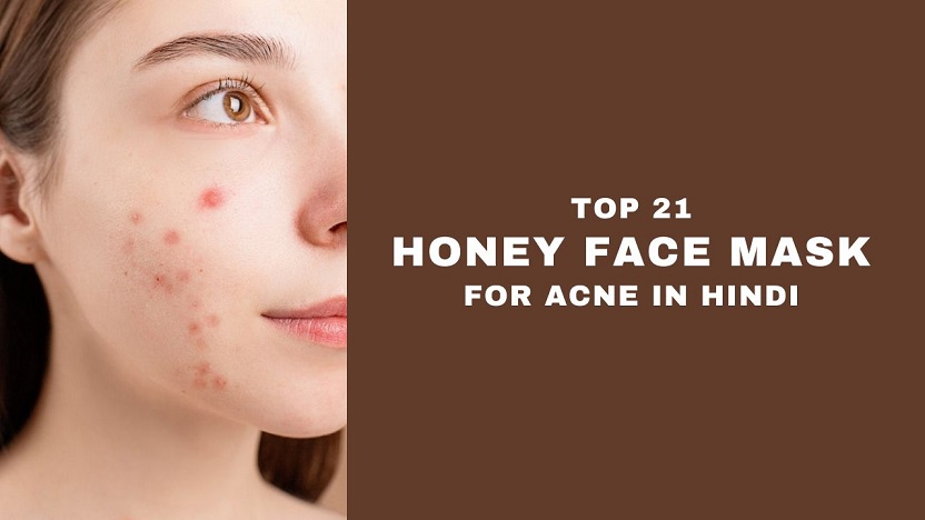 Honey Face Mask for Acne in Hindi