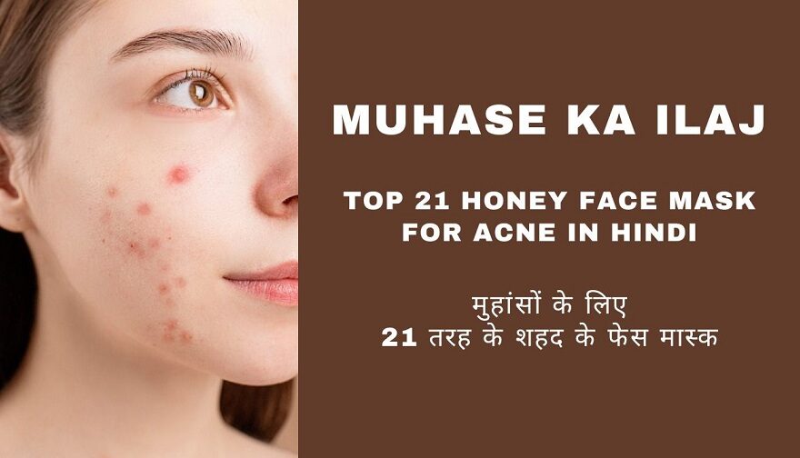 Muhase ka Ilaj – Top 21 Honey Face Mask for Acne in Hindi