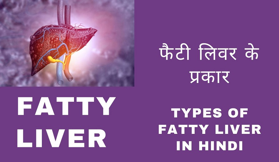 Types of Fatty Liver